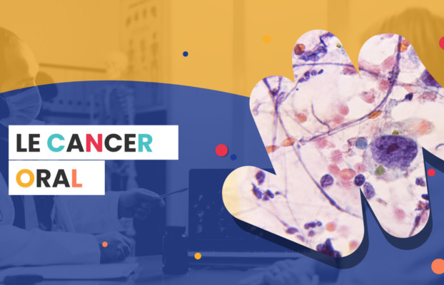 Le cancer oral